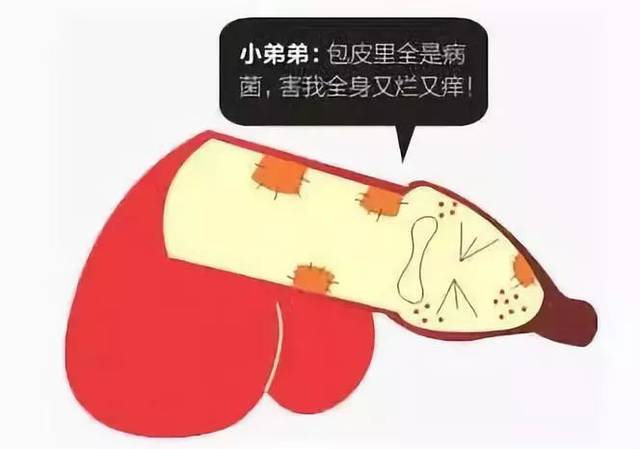 龟头炎诱因和症状有哪些